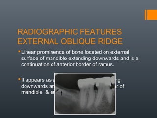 Oblique Ridge Radiography Radiographic anatomical landmarks By Dr. Armaan Singh | PPT