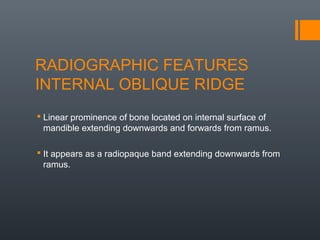Radiographic anatomical landmarks By Dr. Armaan Singh | PPT