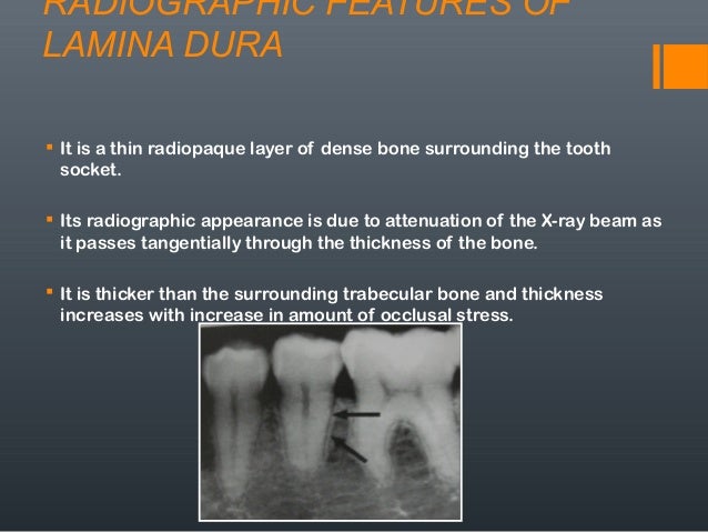 gingival recession