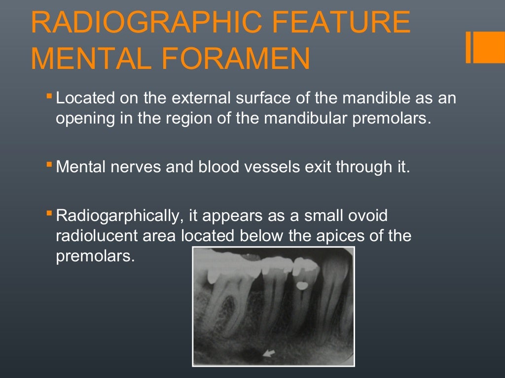 Radiographic anatomical landmarks By Dr. Armaan Singh