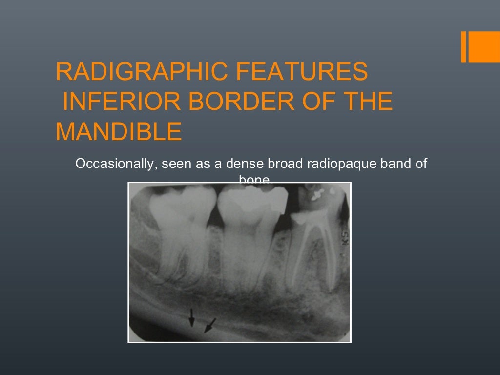 Radiographic anatomical landmarks By Dr. Armaan Singh