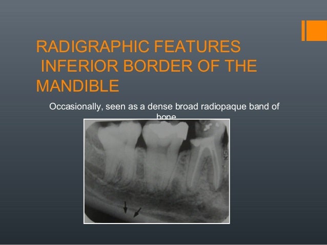 atomic number bone By Armaan anatomical landmarks Radiographic Dr. Singh