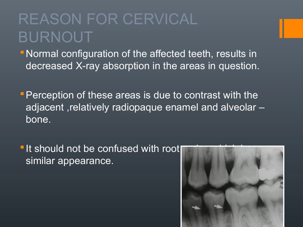 Radiographic anatomical landmarks By Dr. Armaan Singh