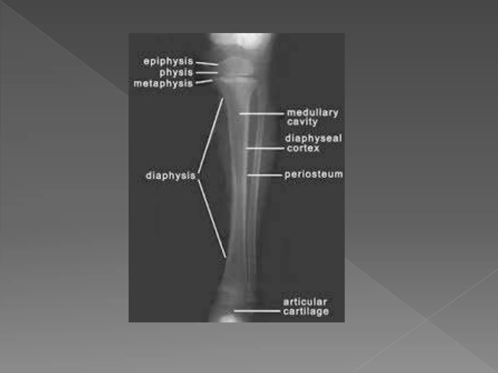 Radiographic anatomy of upper limb | PPTX