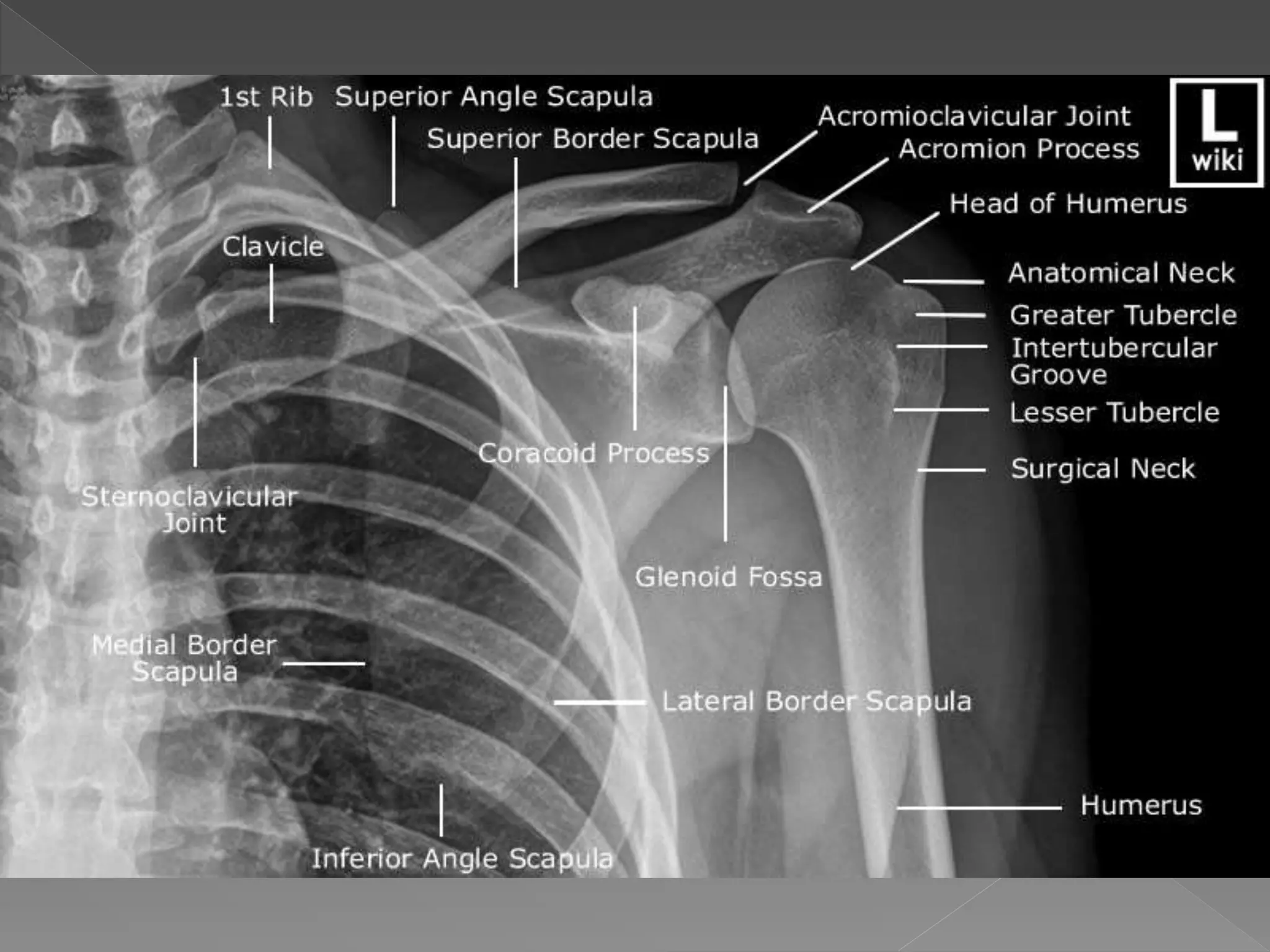 Radiology Anatomy Of Upper Limb Pptx Powerpoint