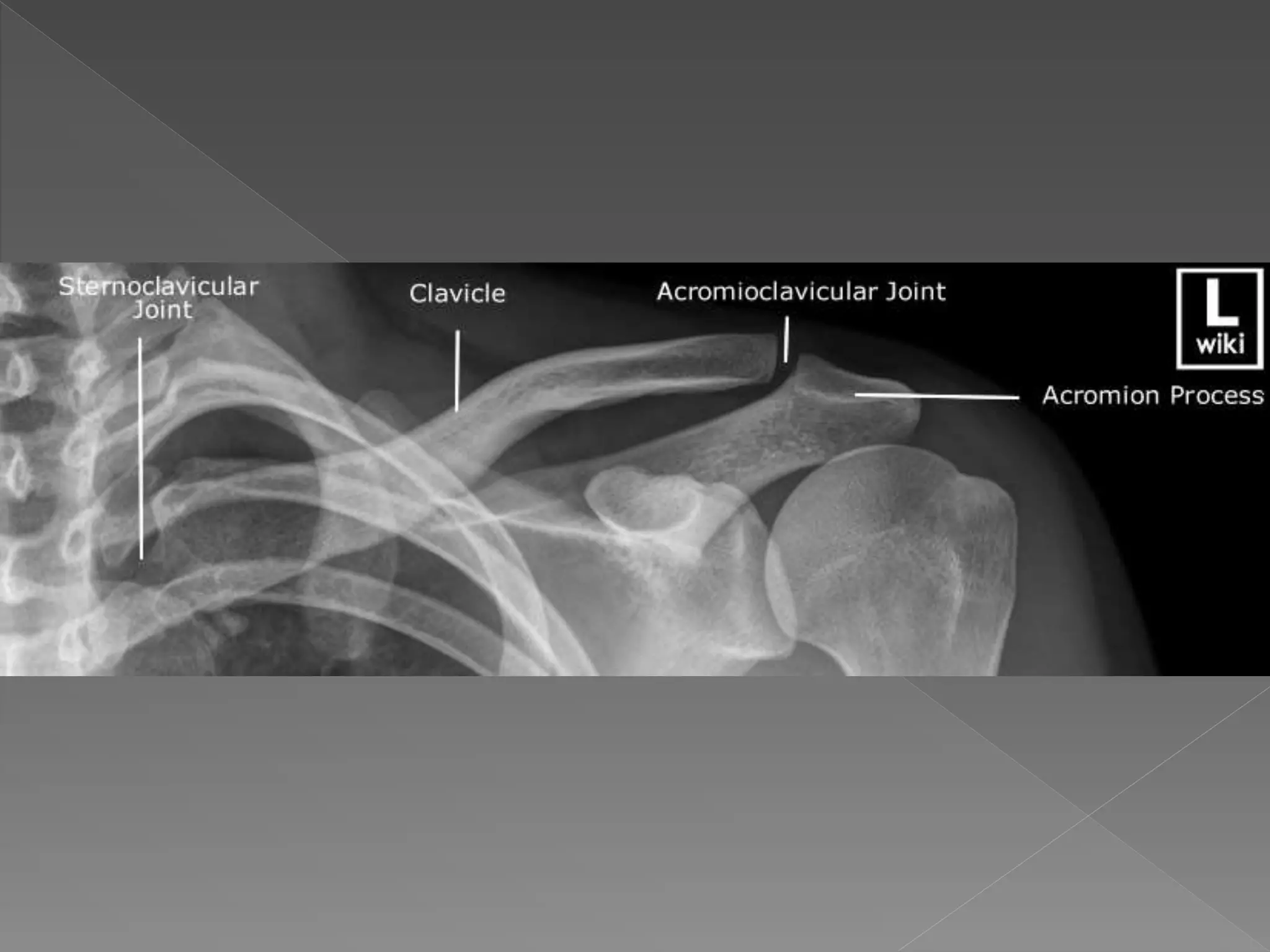 Radiology Anatomy Of Upper Limb Pptx Powerpoint