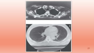 Radiographic anatomy | PPTX