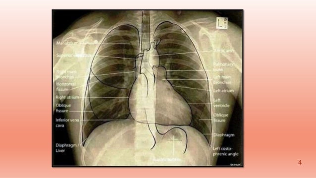 Normal Anatomy Radiology Human Body Anatomy Anatomy