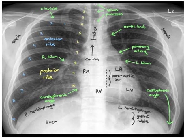 Radiographic anatomy of chest region