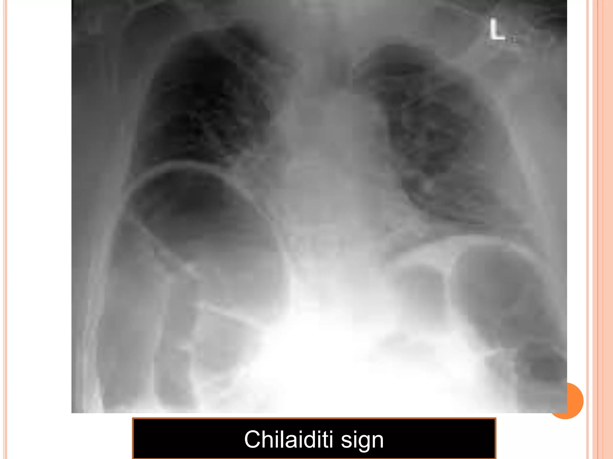 Radiographic Anatomy(chest abdomen and skeletal).pptx