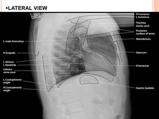 Radiographic Anatomy(chest abdomen and skeletal).pptx