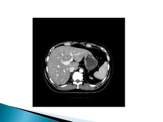 Radiographic anatomy of gastrointestinal tract | PPTX