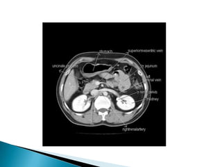 Radiographic anatomy of gastrointestinal tract | PPTX