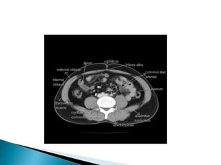 Radiographic anatomy of gastrointestinal tract | PPTX
