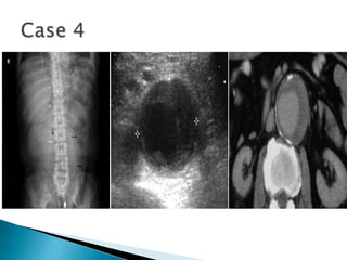 Radiographic anatomy of gastrointestinal tract | PPTX