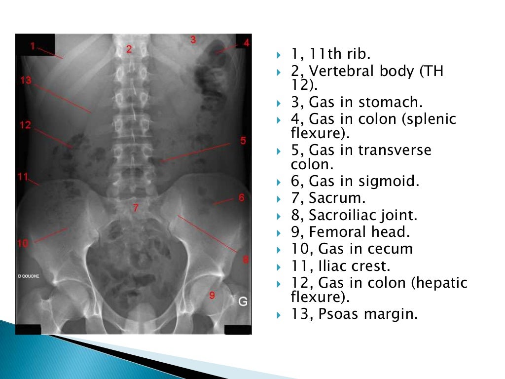 Radiographic anatomy of gastrointestinal tract