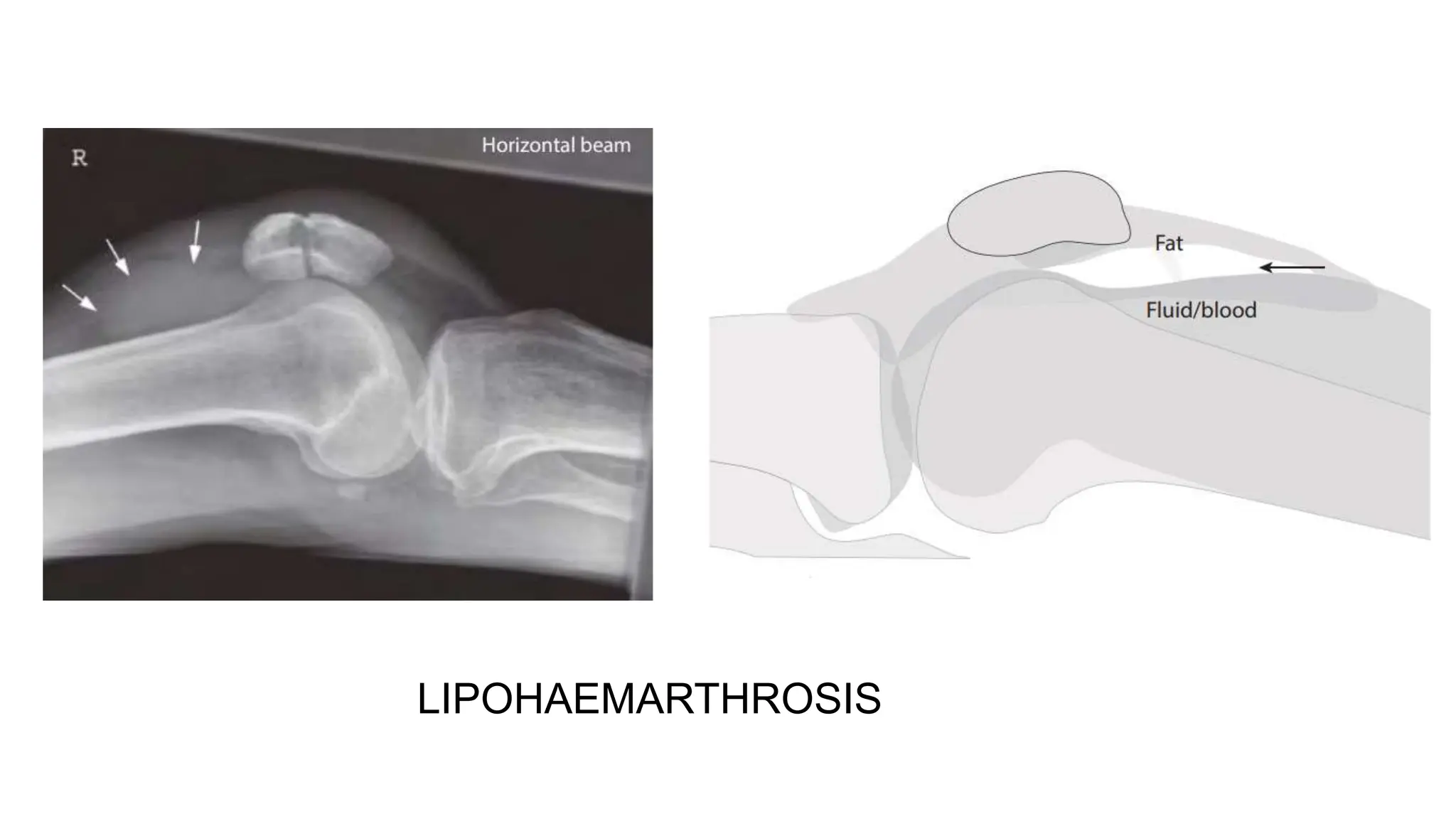 RADIOGRAPHIC ANATOMY OF KNEE JOINT AND ITS RADIOGRAPHIC VIEWS pptx radiographic-anatomy-of-knee-joint-and-its-radiographic-views-pptx