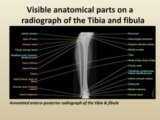 Radiographic Anatomy of the Lower Limbs.pptx