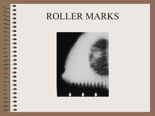 ROLLER MARKS 