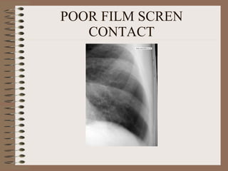 POOR FILM SCREN CONTACT 