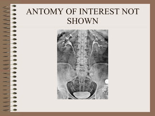 ANTOMY OF INTEREST NOT SHOWN 