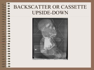 BACKSCATTER OR CASSETTE UPSIDE-DOWN 