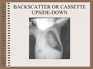 BACKSCATTER OR CASSETTE UPSIDE-DOWN 