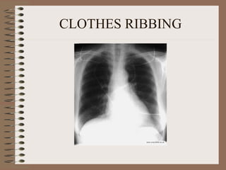 CLOTHES RIBBING 
