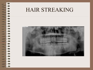 HAIR STREAKING 