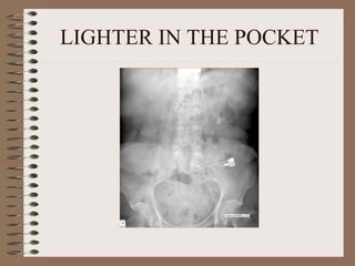 LIGHTER IN THE POCKET 