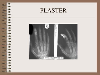 PLASTER 