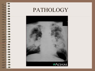 PATHOLOGY 