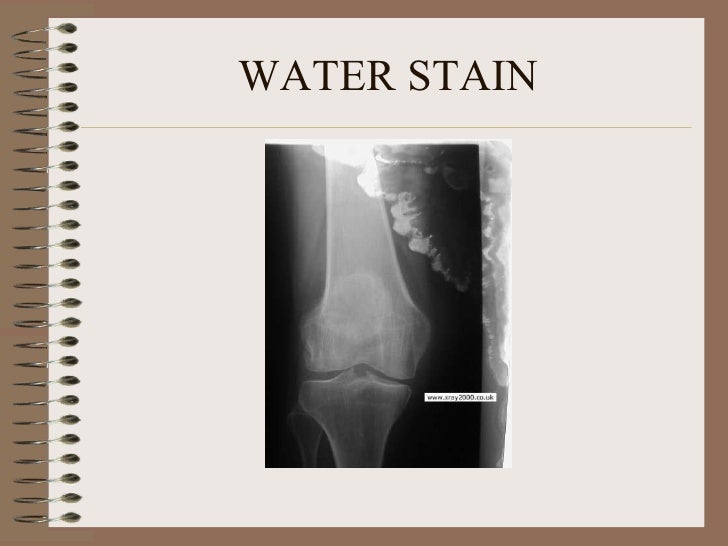 Radiographic artifacts