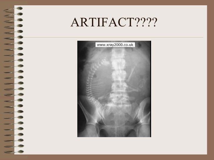 Radiographic artifacts