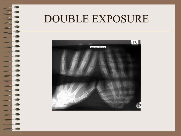 Radiographic artifacts