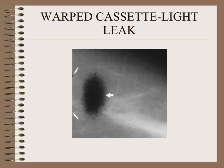 Radiographic artifacts