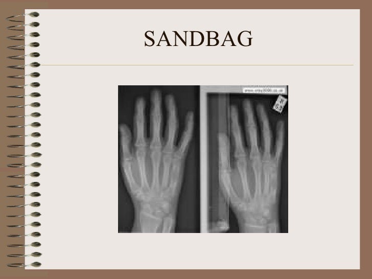 Radiographic artifacts