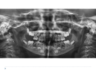 Radiographic assessment in paediatric dentistry | PPTX