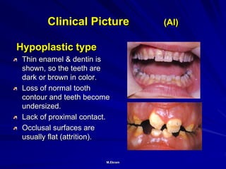 Radiographicassessmentofdevelopmentalanomalies 190829211105 ppt radiographicassessmentofdevelopmentalanomalies-190829211105-ppt