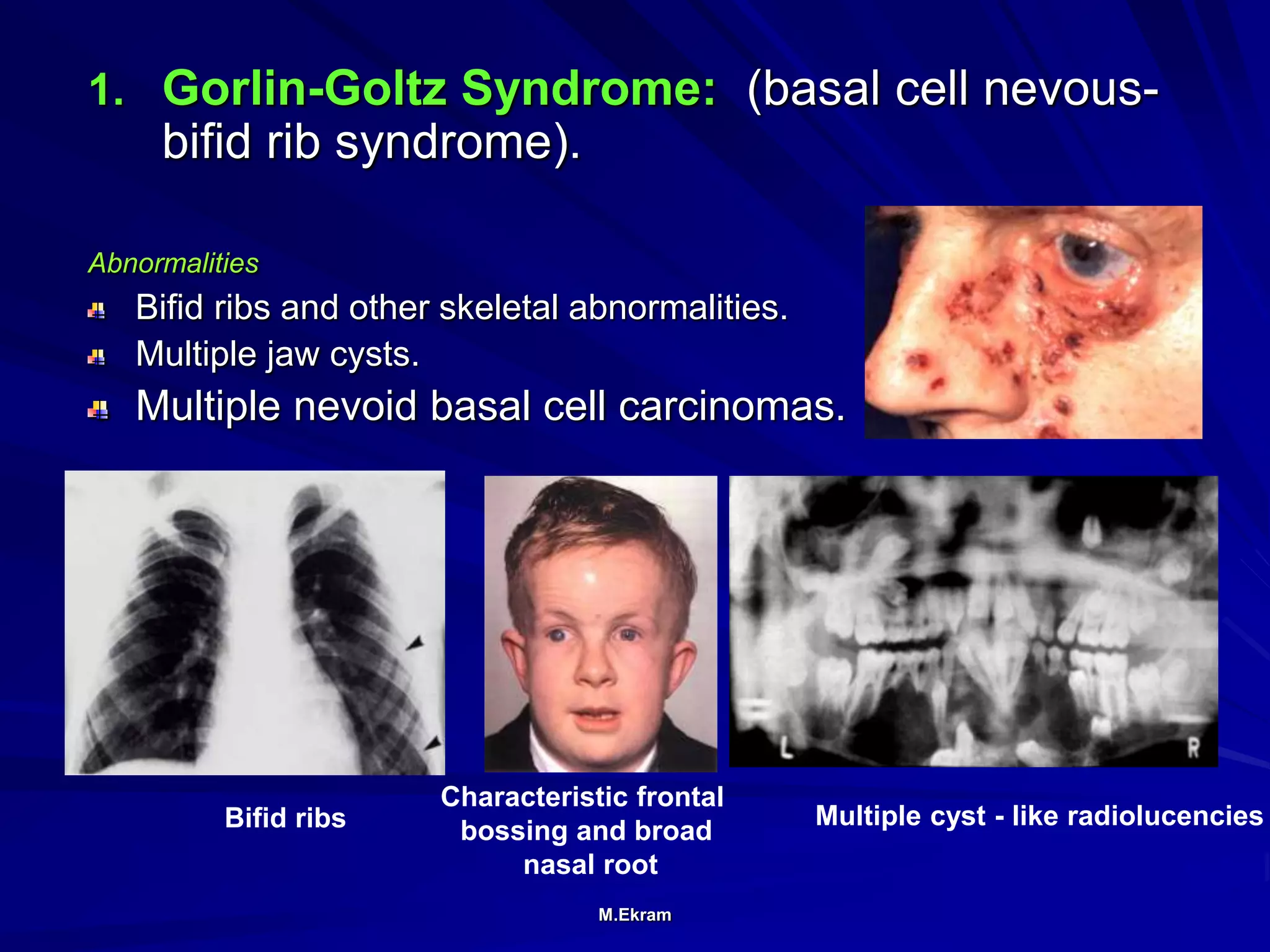 Radiographic assessment of teeth developmental anomalies | PPT