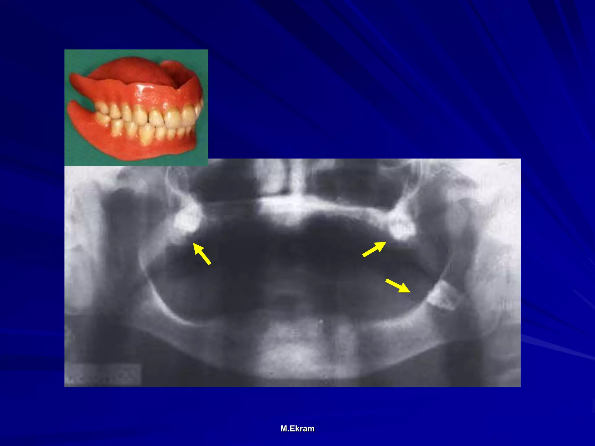 Teeth Tomorrow Radiograph Radiographic assessment of teeth developmental anomalies | PPT