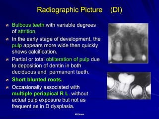 Radiographic assessment of teeth developmental anomalies | PPT