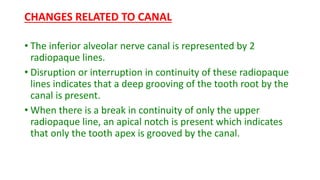 Radiographic assessment of impacted teeth | PPTX