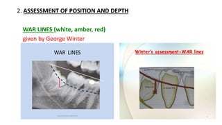 Radiographic assessment of impacted teeth | PPTX