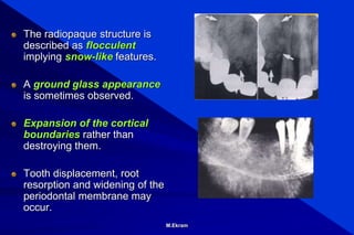 Radiographic assessment of malignant disease of the ortal cavity & jaws ...
