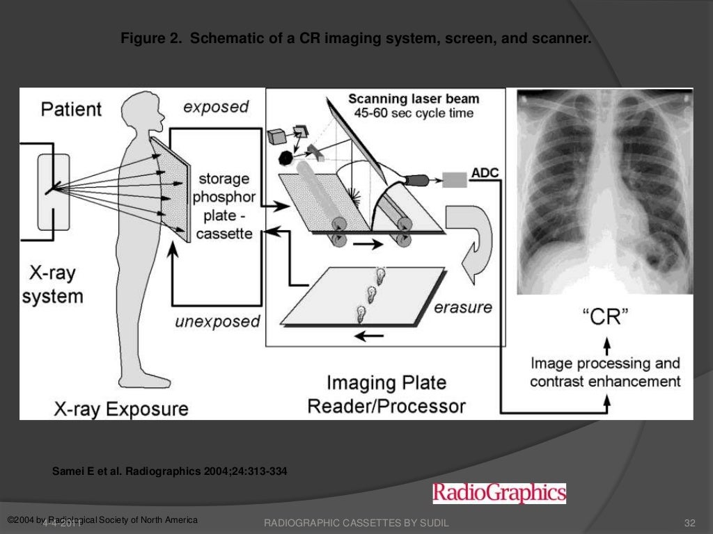 radiographic-cassettes