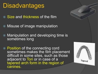 Disadvantages
 Size and thickness of the film
 Misuse of image manipulation
 Manipulation and developing time is
sometimes long
 Position of the connecting cord
sometimes makes the film placement
difficult in some sites, such as those
adjacent to Tori or in case of a
tapered arch form in the region of
canines.
 