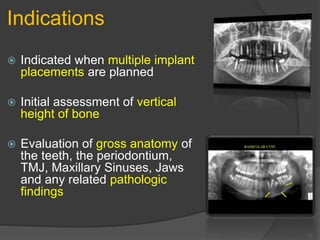Indications
 Indicated when multiple implant
placements are planned
 Initial assessment of vertical
height of bone
 Evaluation of gross anatomy of
the teeth, the periodontium,
TMJ, Maxillary Sinuses, Jaws
and any related pathologic
findings
 
