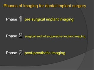 Phases of imaging for dental implant surgery
Phase pre surgical implant imaging
Phase surgical and intra-operative implant imaging
Phase post-prosthetic imaging
 