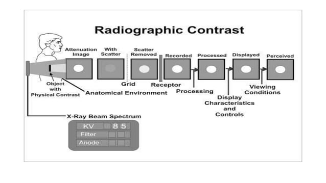 Radiographic Image contrast & image resolution